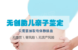 枣庄怀孕期间怎么鉴定是谁的孩子,枣庄孕期亲子鉴定费用是多少钱 枣庄怀孕期间怎么鉴定是谁的孩子,枣庄孕期亲子鉴定费用是多少钱