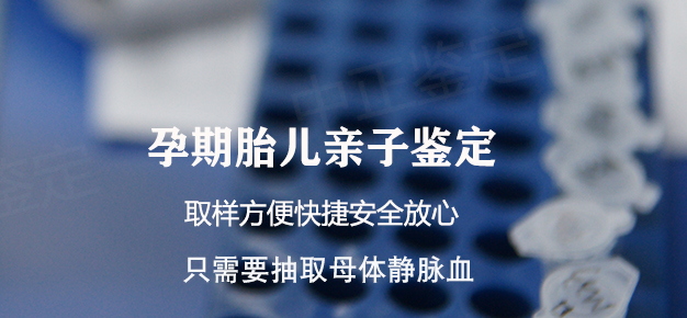 枣庄怀孕亲子鉴定准确可靠吗,枣庄产前亲子鉴定中心在哪里 枣庄怀孕亲子鉴定准确可靠吗,枣庄产前亲子鉴定中心在哪里