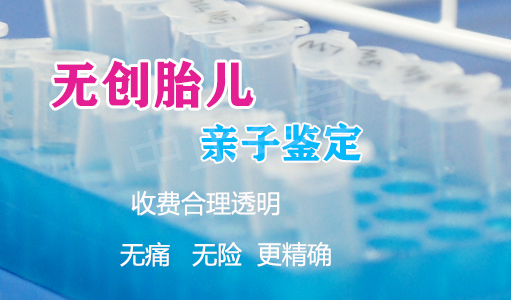 枣庄孕期亲子鉴定需要什么手续,枣庄到哪里孕期亲子鉴定 枣庄孕期亲子鉴定需要什么手续,枣庄到哪里孕期亲子鉴定